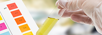 Chromatographie